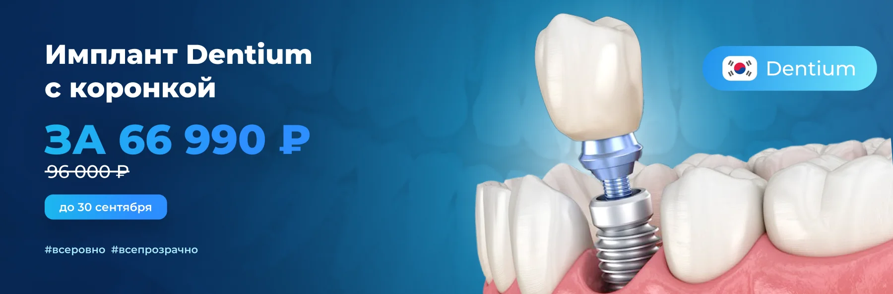 Имплант Dentium + профессиональное протезирование +  коронка всего за 66 990 рублей баннер