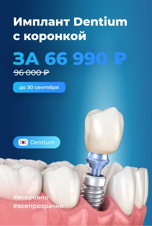 Имплант Dentium + профессиональное протезирование +  коронка всего за 66 990 рублей баннер